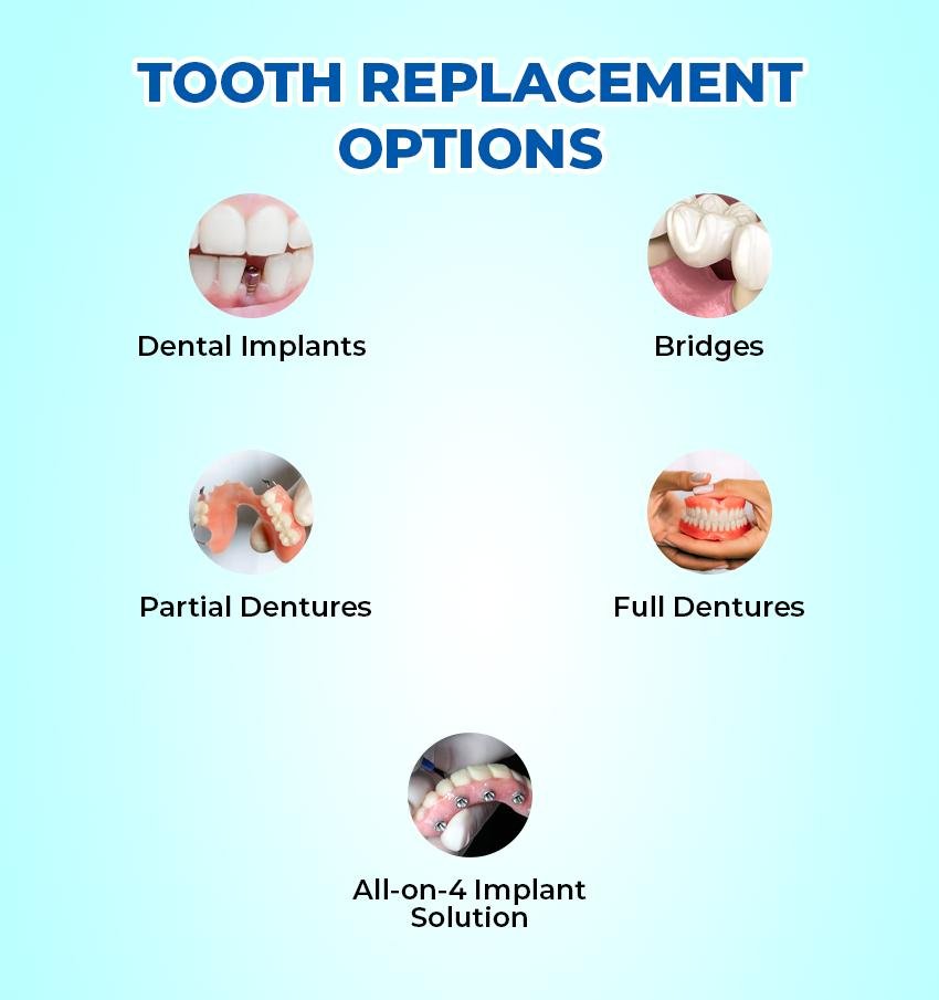 Tooth replacement procedure
